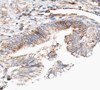 CLDN7 / Claudin 7 Antibody