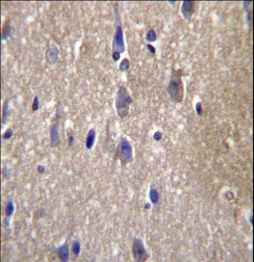Polyclonal Rabbit anti-Human CPN2 Antibody (aa21-50, IHC, WB)