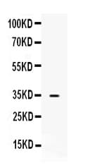 NAT1 / AAC1 Antibody