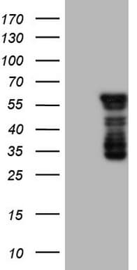 Monoclonal Mouse anti-Human BHLHE41 / BHLHB3 / SHARP1 Antibody (clone OTI7E8, aa1-297, IHC, WB)