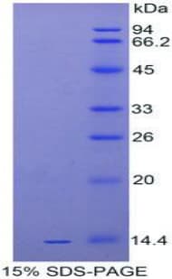 Human IL-33 Protein (Recombinant His-T7)