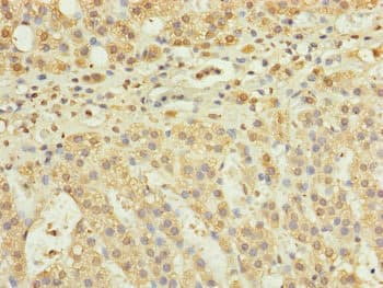 RPP25L / C9orf23 Antibody