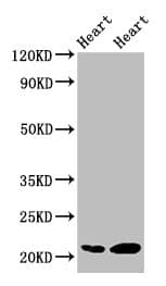 CRYAB / Alpha B Crystallin Antibody (aa1-175)