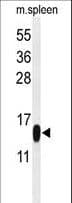 PLA2G1B Antibody (aa116-145)