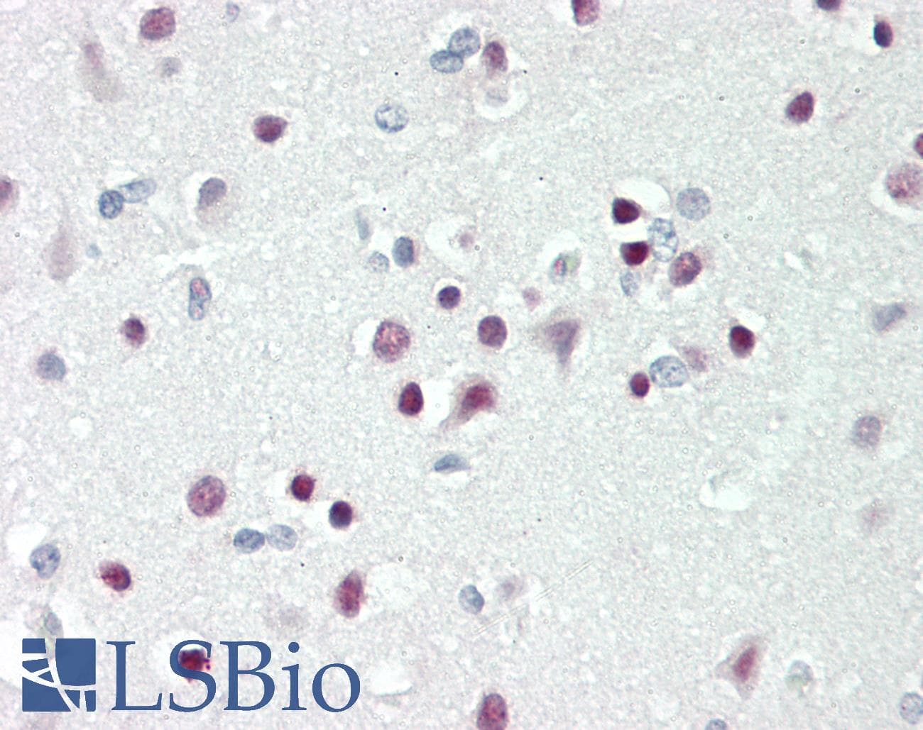 Polyclonal Rabbit anti-Human TBX15 Antibody (aa412-461, IHC, WB)