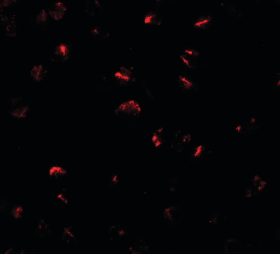 BMP15 Antibody