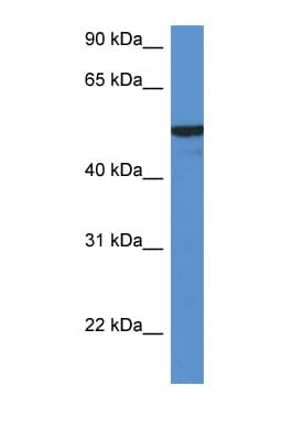 Polyclonal Rabbit anti-Human FMO2 Antibody (aa102-151, WB)