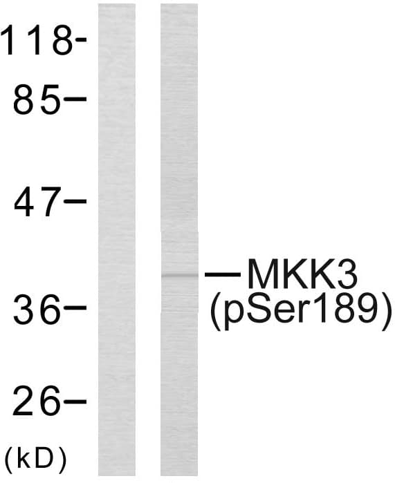 MAP2K3 / MEK3 / MKK3 Antibody (phospho-Ser189)
