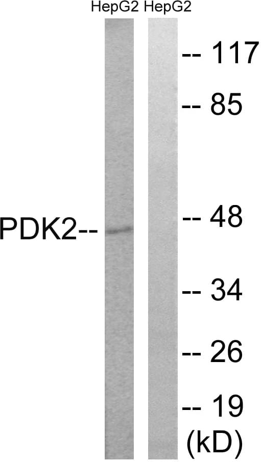 Polyclonal Rabbit anti-Human PDK2 Antibody (aa260-309, WB)