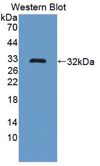 Complement C2 Antibody (aa473-723, Cy3)