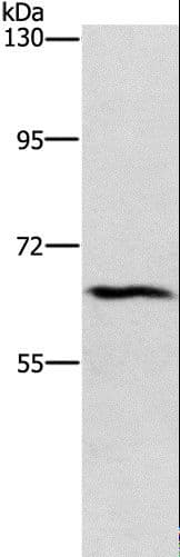 Polyclonal Rabbit anti-Human CERKL Antibody (WB)