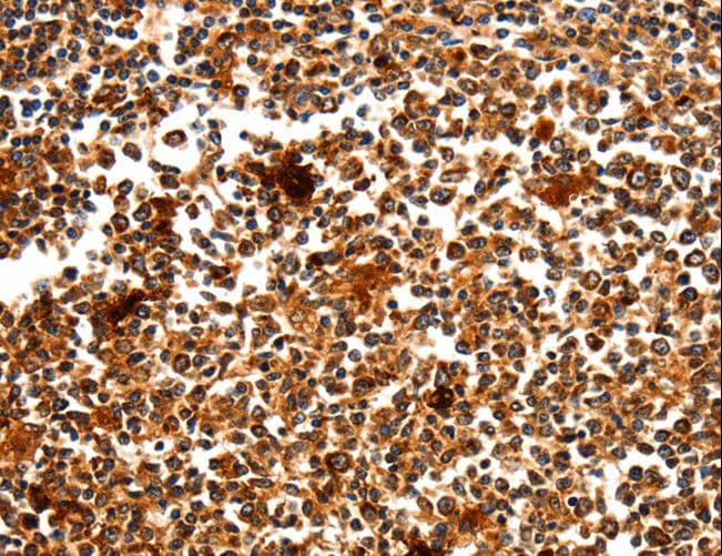 Myozenin / MYOZ1 Antibody