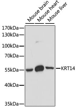 KRT14 / CK14 / Cytokeratin 14 Antibody