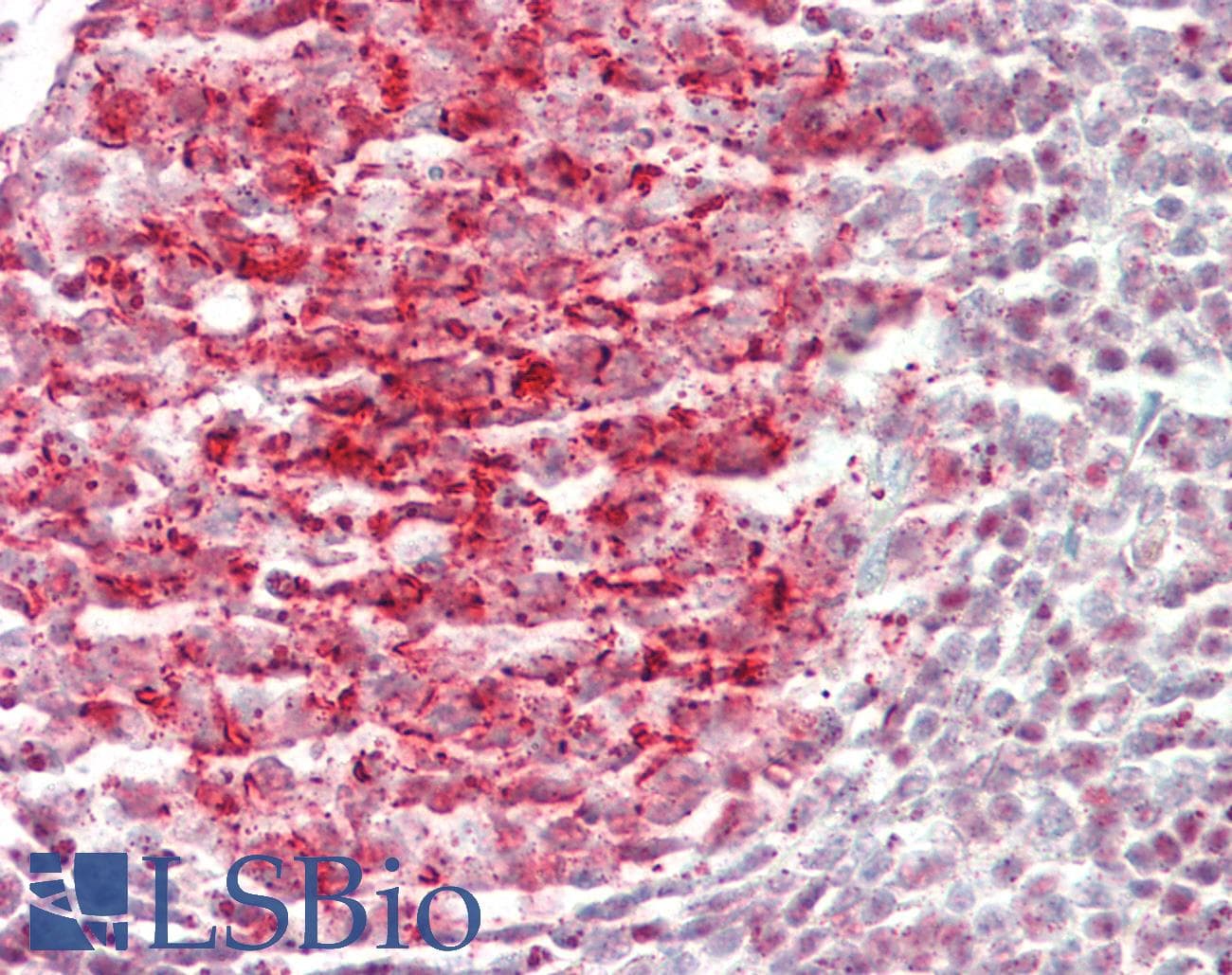 PDE4B Antibody (aa467-516)