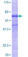 Human ZDHHC6 Protein (Recombinant GST)