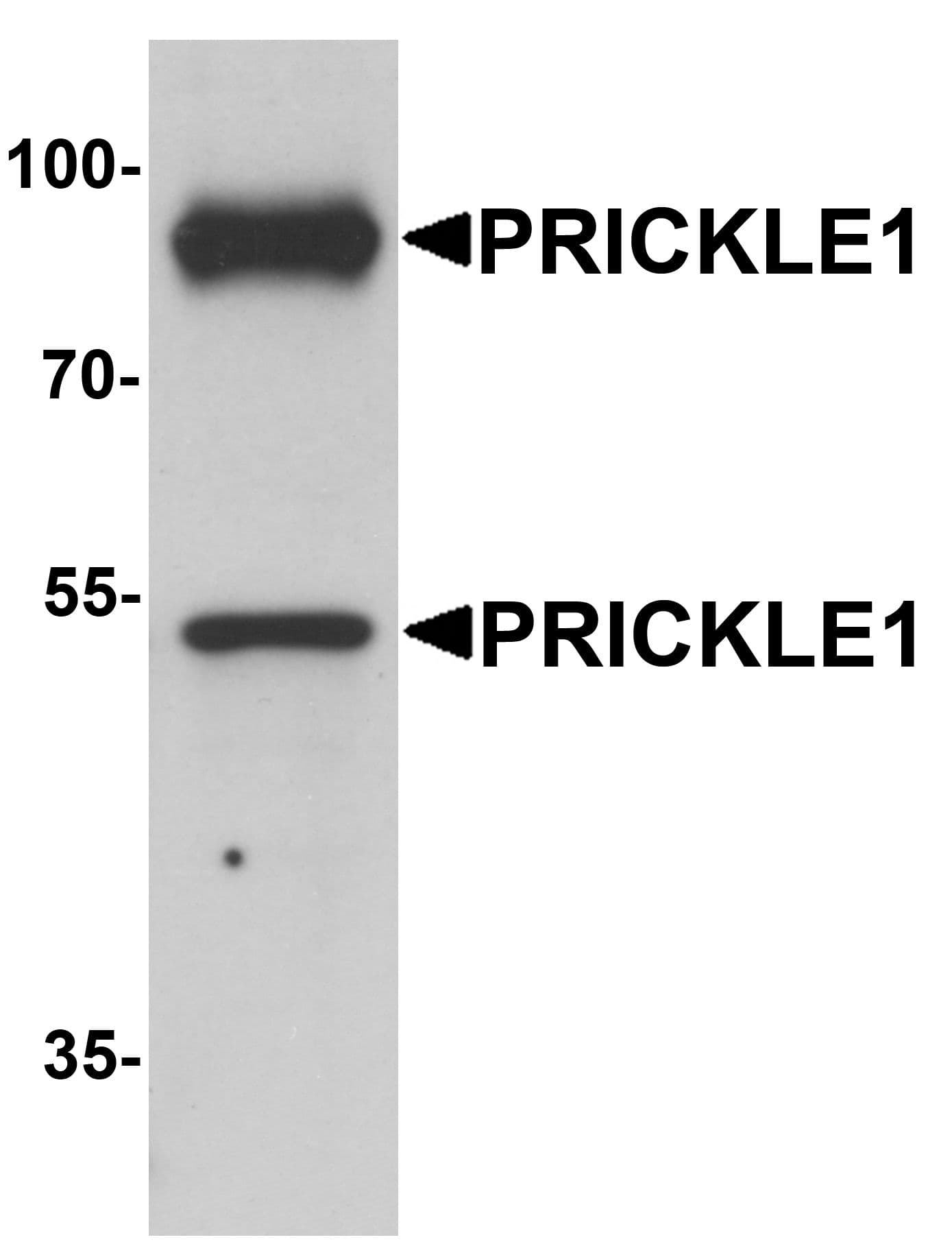 PRICKLE1 Antibody