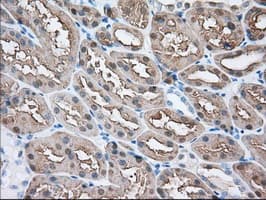 BHMT Antibody (clone OTI2F6)