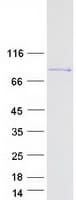 Human Zyxin Protein (Recombinant Myc-DDK (Flag))