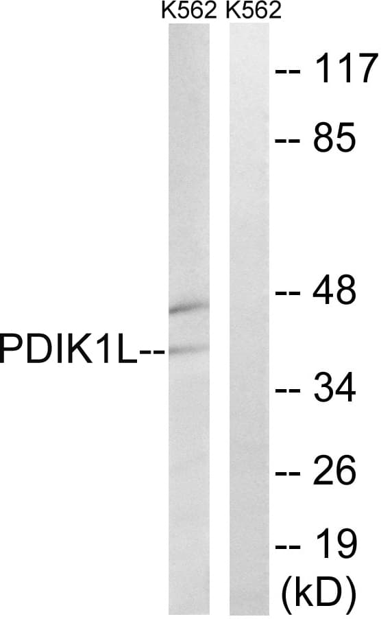 Polyclonal Rabbit anti-Human PDIK1L Antibody (aa101-150, IHC, WB)