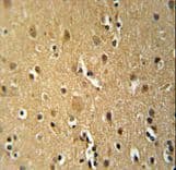 Polyclonal Rabbit anti-Human CD30 Antibody (aa458-487, IHC, WB)