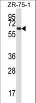MMP17 Antibody (aa432-460)