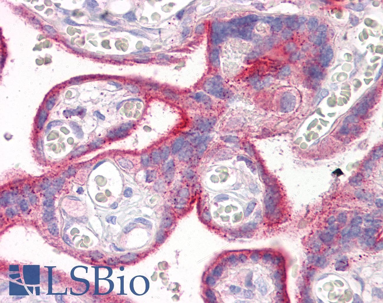 IHC-plus™ ERBB2 / HER2 Antibody (clone 3B5)