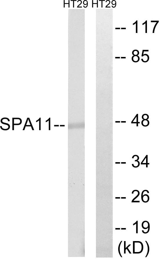 SERPINA11 Antibody (aa191-240)