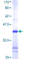 Human CHUK / IKKA / IKK Alpha Protein (Recombinant GST, N-terminus)
