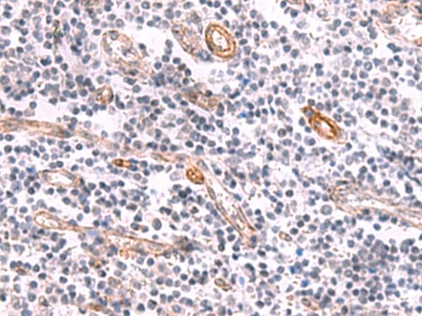KCNK15 Antibody