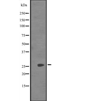 SYCP3 / SCP3 Antibody