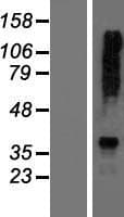 AGXT2 Protein (Over-Expression Lysate Myc-DDK (Flag))