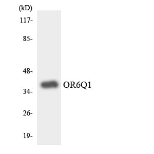 OR6Q1 Antibody (aa13-62)