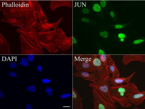 JUN / c-Jun Antibody (clone UMAB67)