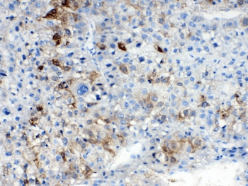 Polyclonal Rabbit anti-Human AKR1B10 Antibody (IHC, WB)