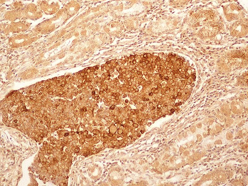 IL27RA Antibody (aa200-250, clone 34N4G11)