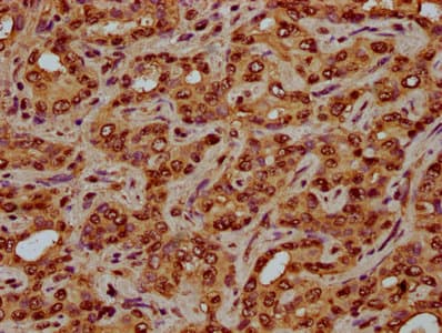 HIST1H4I Antibody