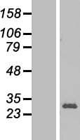 RPL13 / Ribosomal Protein L13 (Over-Expression Lysate Myc-DDK (Flag))