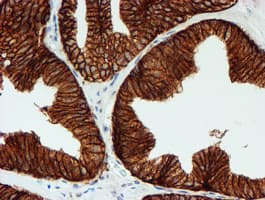 Monoclonal Mouse anti-Human FXYD3 Antibody (clone OTI1E8, IHC, IF, WB)
