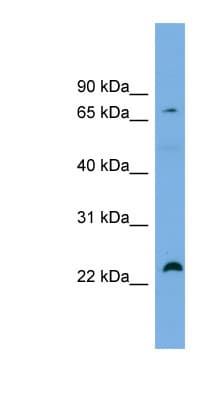 SPG20 / SPARTIN Antibody (aa431-480)