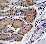 CTSO Antibody (aa69-98)
