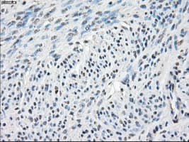 Monoclonal Mouse anti-Human CA9 / Carbonic Anhydrase IX Antibody (clone OTI1G7, IHC, WB)