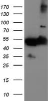 TUBAL3 Antibody (clone OTI3B7)
