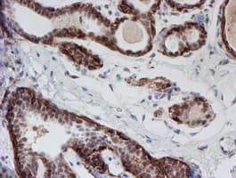 ATRIP Antibody (clone OTI5E7)