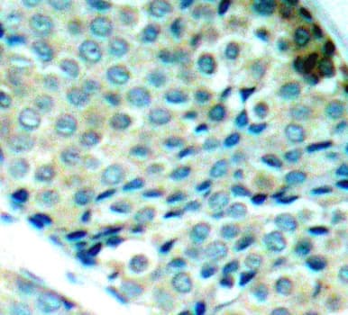HSPB1 / HSP27 Antibody (phospho-Ser78)