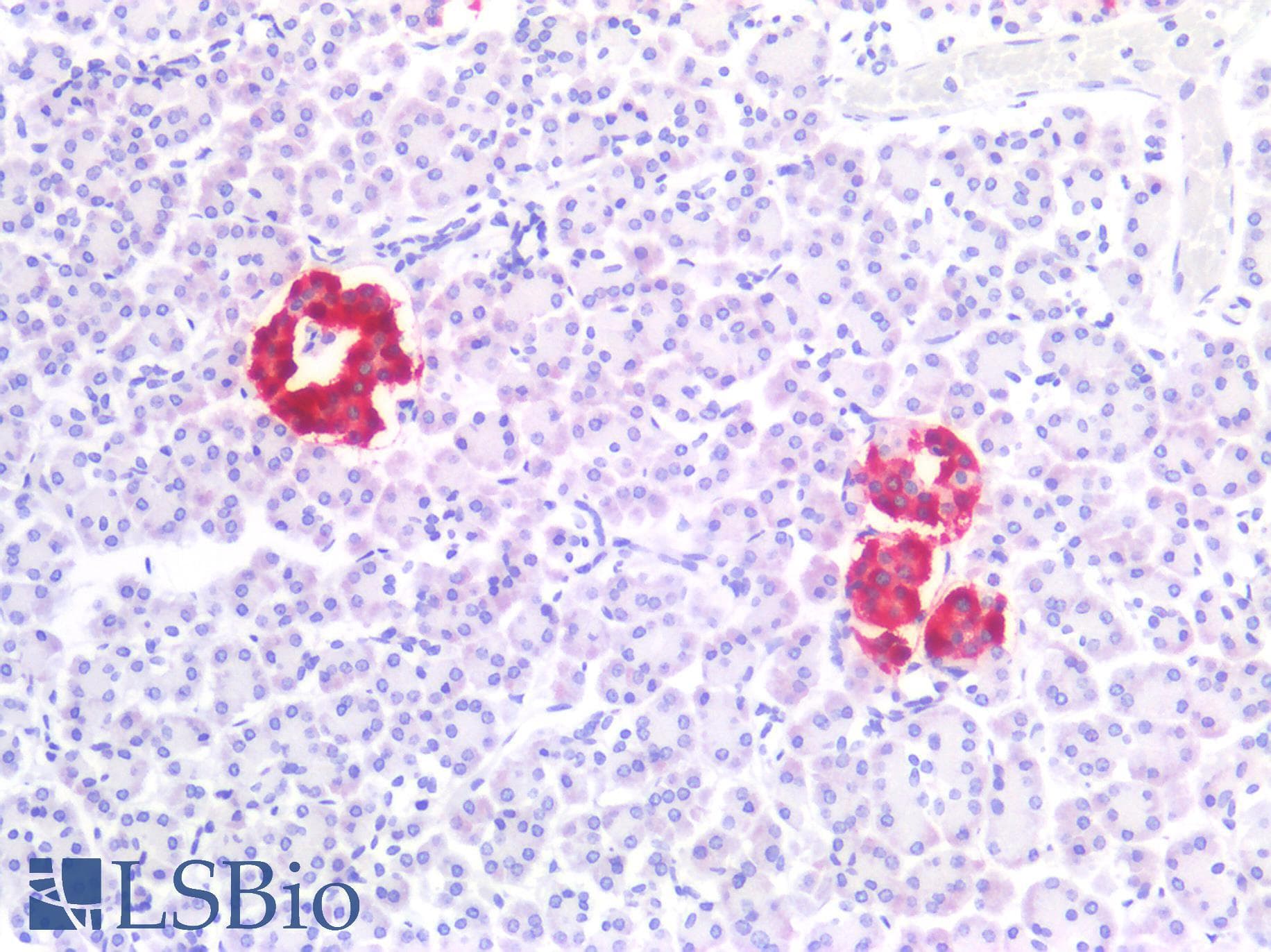 PathPlus™ Polyclonal Rabbit anti-Human IAPP / Amylin Antibody (IHC)