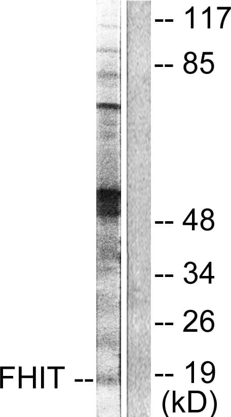 FHIT Antibody (aa81-130)