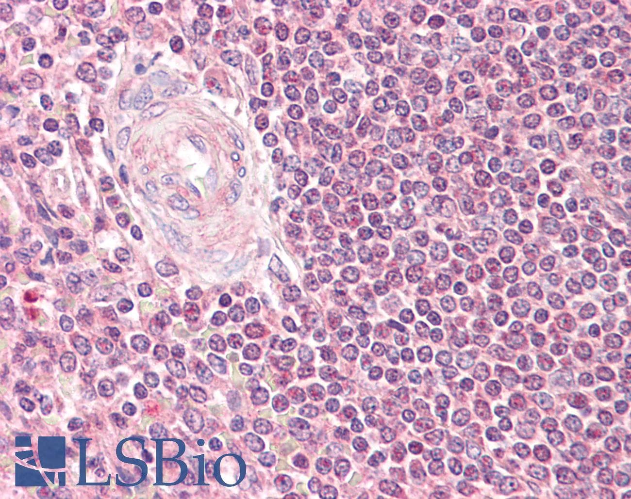 IHC-plus™ Polyclonal Rabbit anti-Human RAD52 Antibody (aa70-119, IHC, IF, WB)