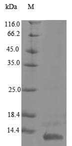 Human UL131 Protein (Recombinant 10His, N-terminus)