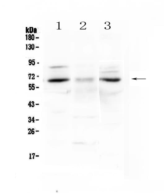 CCKBR / Cckb Antibody