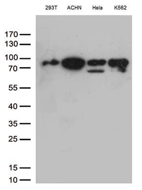 Monoclonal Mouse anti-Human DDX50 Antibody (clone OTI4F7, aa1-287, IHC, WB)
